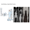 Picture of Digital radiography (DR) equipment for medical use