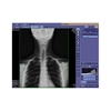 Image sur Digital radiography (DR) equipment for medical use