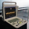 Изображение Digital Ultrasonic Diagnostic Imaging System