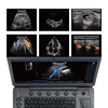 Picture of Portable Color Doppler Ultrasound System